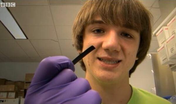 Egy 15 éves fiú,aki új módszert talált fel a rák diagnosztizálására Jack Andraka most elsős a középiskolában, és feltalált egy olyan papírszenzort, ami 5 perc alatt felfedezi a tüdő-, petefészek-, és hasnyálmirigyrákot, és mindez csak körülbelül 3 centbe kerül.